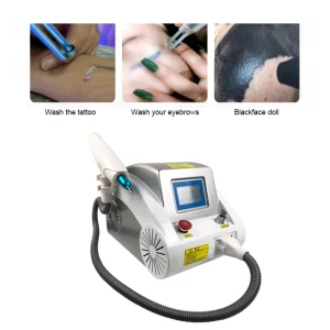 Factory price tattoo removal nd yag laser beauty equipment